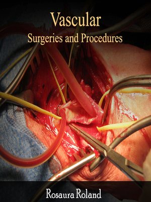 cover image of Vascular Surgeries and Procedures